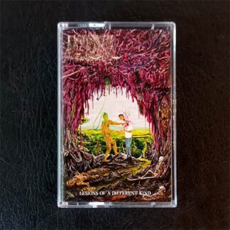 Cassette UNDEATH - Lesions Of A Different Kind